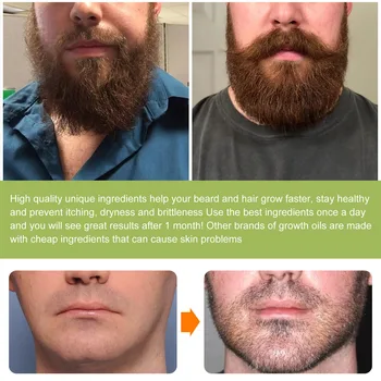 Sakal Bakım Serumları Sakal Yağı Erkekler İçin Kür Sakal Kaşıntı Teşvik sakal uzatma Ve Parlaklık Uzun Ve Kısa Sakal Bakımı