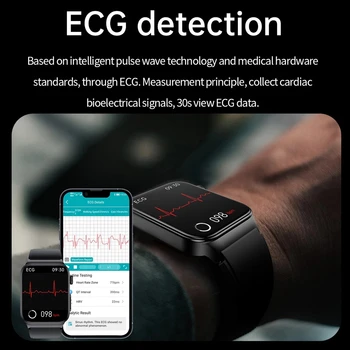 Xiaomi EKG + PPG Akıllı İzle Erkekler Lazer Tedavisi Hipertansiyon Hiperglisemi Hiperlipidemi Kalp Hızı Sağlıklı Spor Erkekler Smartwatch